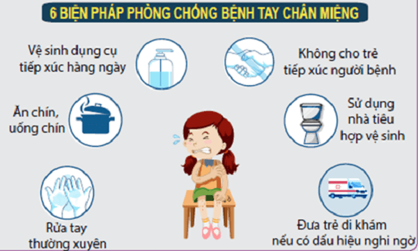 Phòng bệnh tay chân miệng ở trẻ