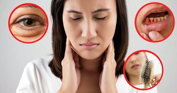 Dấu hiệu nhận biết cơ thể thiếu vitamin