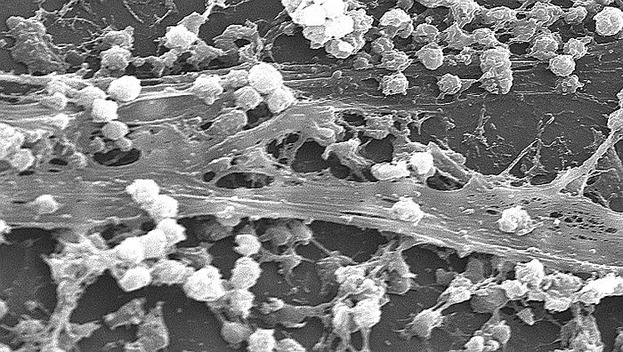 Nghiên cứu tác dụng kháng biofilm của hạt nano polymer bọc α-mangostin lên vi khuẩn gây bệnh sinh biofilm Streptococcus mutans và Staphylococcus aureus