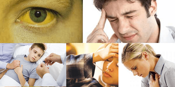 Triệu chứng, dấu hiện viêm gan B